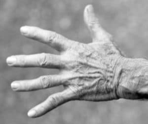 STIMCARE-ARTHRITIS-HANDS-PAIN-JOINTS-RELIEF