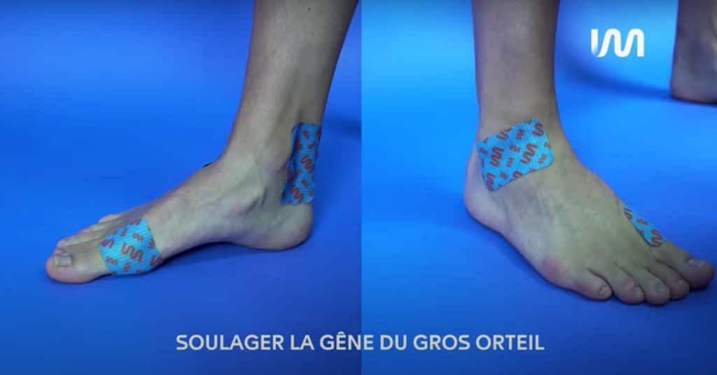 STIMCARE-TUTO-SOULAGER-LA-GENE-DU-GROS-ORTEIL