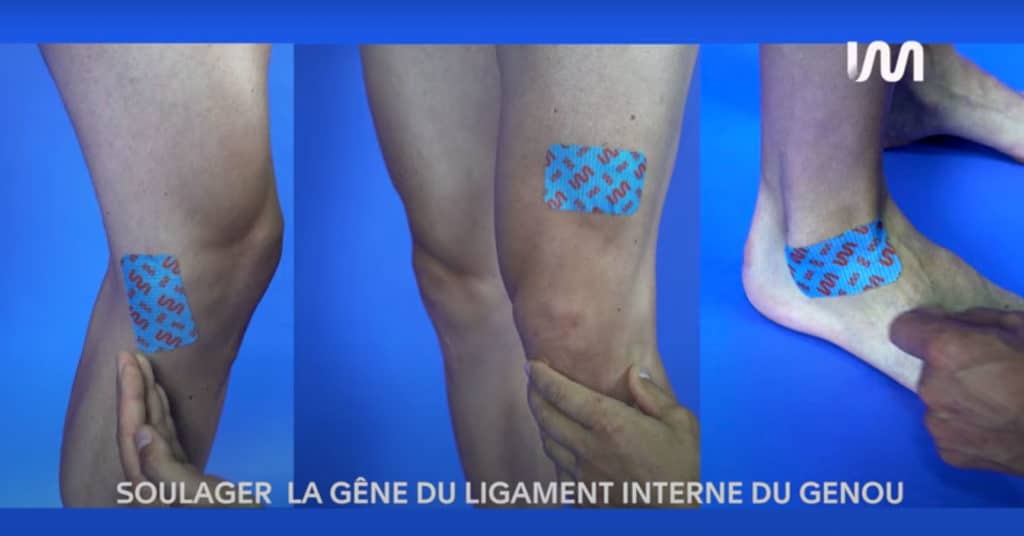 STIMCARE-TUTO-SOULAGER-LA-GENE-DU-LIGAMENT-LATERAL-INTERNE-DU-GENOU