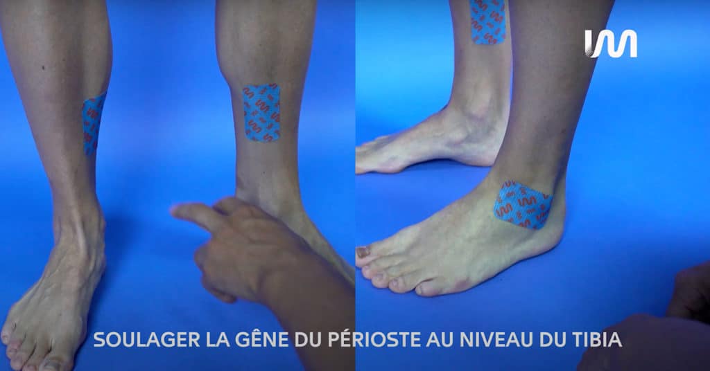 STIMCARE-TUTO-SOULAGER-LA-GENE-DU-PERIOSTITE-DU-TIBIA