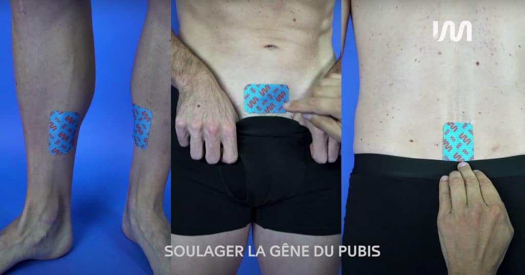 STIMCARE-TUTO-SOULAGER-LA-GENE-DU-PUBIS-DOS-ADDUCTEURS