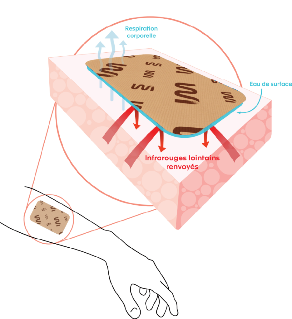 Fonctionnement patch
